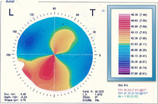 <p>what type of scale is this? </p>