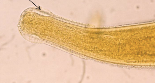 <p><span><span>Which parasites are shown in this picture, and which morphological feature supports this conclusion?</span></span></p>