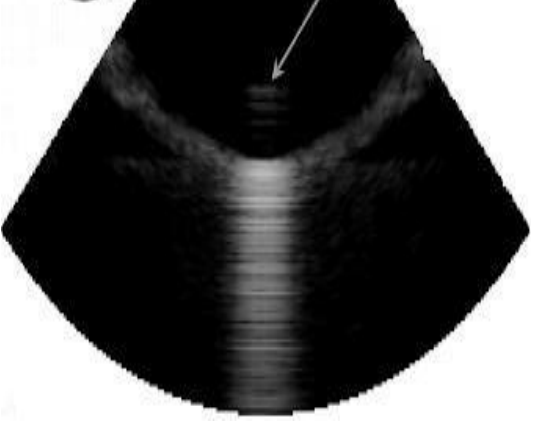 <p>what kind of artifact is this?</p>