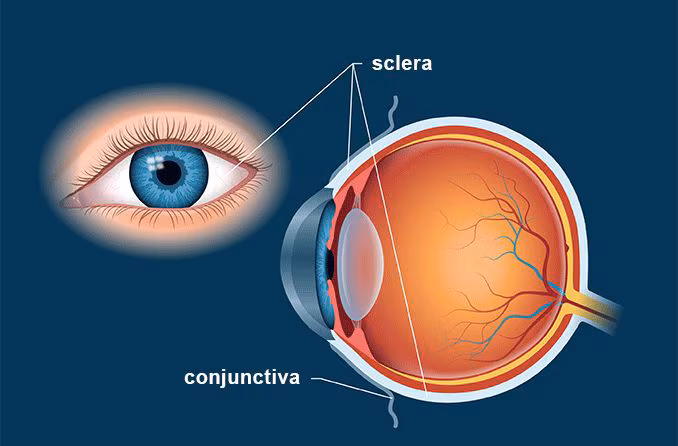 <p>Tough white outer layer of the eye</p><p>It helps protect the eye from injury</p>