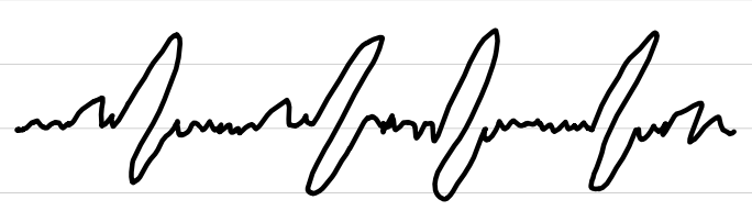 <ul><li><p>rate: variable</p></li><li><p>rhythm: <span style="color: red;">irregularly irregular</span></p></li><li><p>P waves: <span style="color: red;">variable</span></p></li><li><p>PR interval: <span style="color: red;">not measurable</span></p></li><li><p>QRS complexes: <0.10 sec</p></li><li><p>ST segments: <span style="color: red;">may not be seen</span></p></li></ul><p></p>