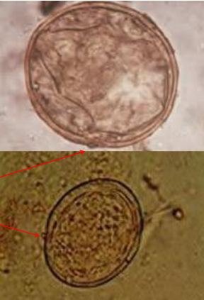 <ul><li><p>75-90 x 60-68 um</p></li><li><p>Round to slightly oval</p></li><li><p>Small, rudimentary, <u>lateral knoblike spine</u></p><ul><li><p>Rarely visible</p></li></ul></li></ul><p></p>