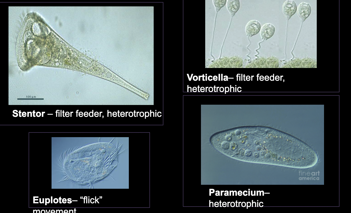 <p>What bacteria is this?</p>