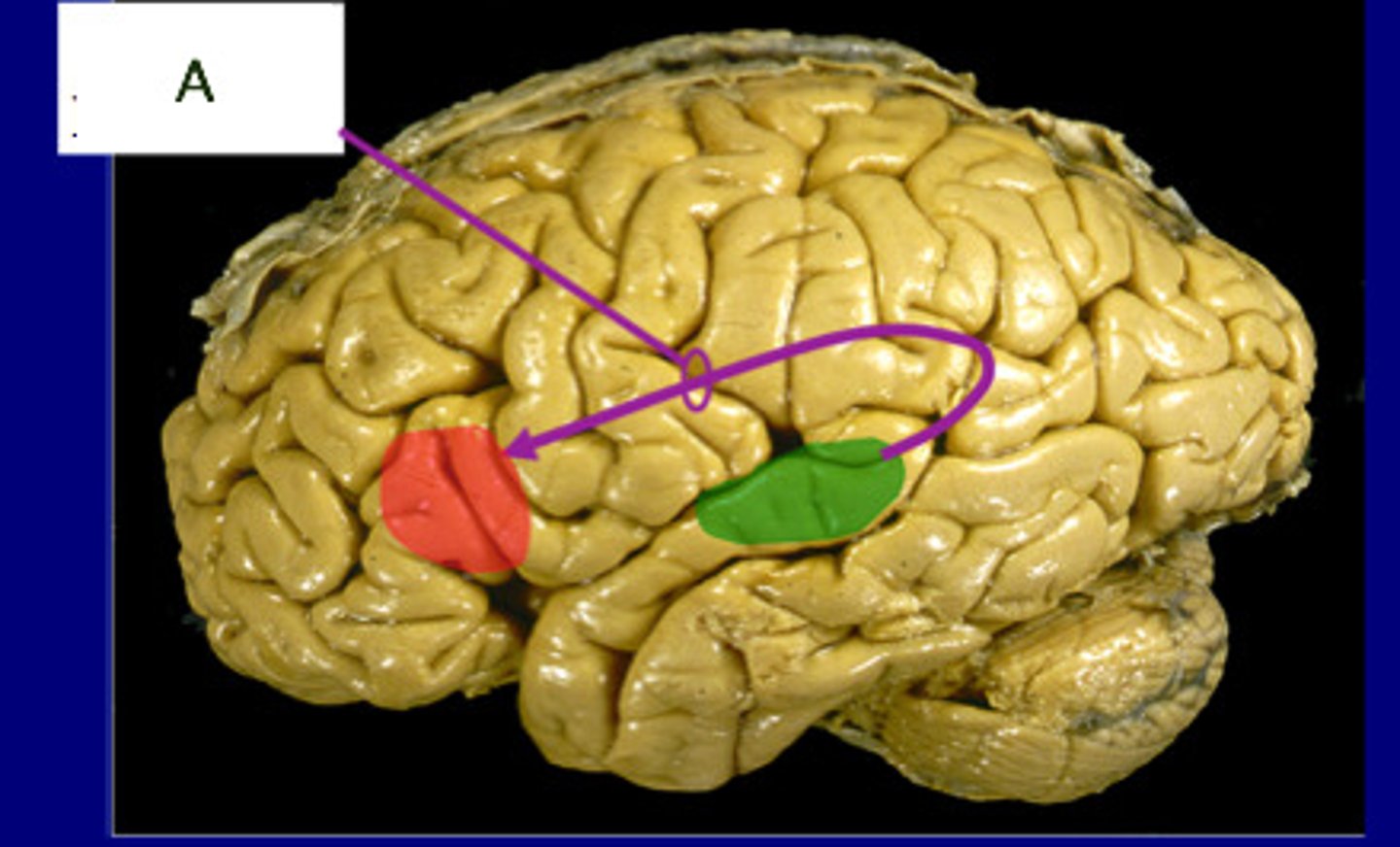<p>connects Wernicke's area and Broca's area</p>