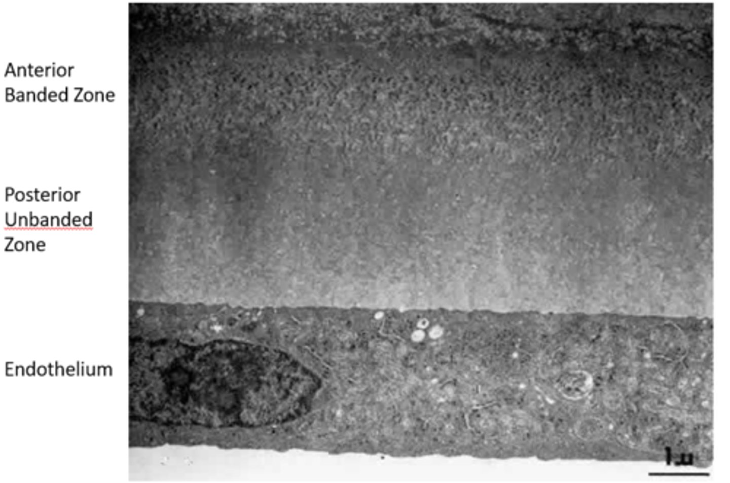 <p>-Basement membrane of Endothelium</p><p>-Thickens throughout life from 3 um to 15 um</p><p>-Regenerates if damaged</p><p>-Anterior banded zone laid down before birth</p><p>-Posterior unbanded zone laid down after birth</p><p>-Terminates abruptly at Schwalbe's line</p>