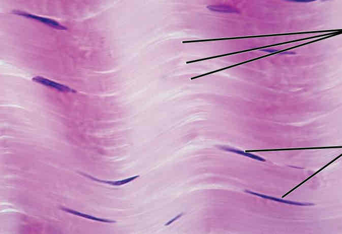 <p>Wavy fibers running in the same direction</p>