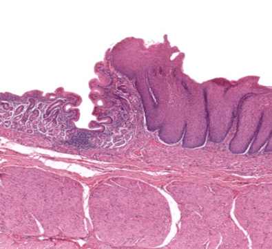 <p>Gastro-esophagol junction</p>