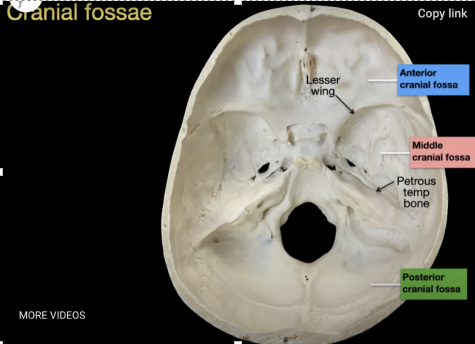 <p>Middle cranial fossa</p>