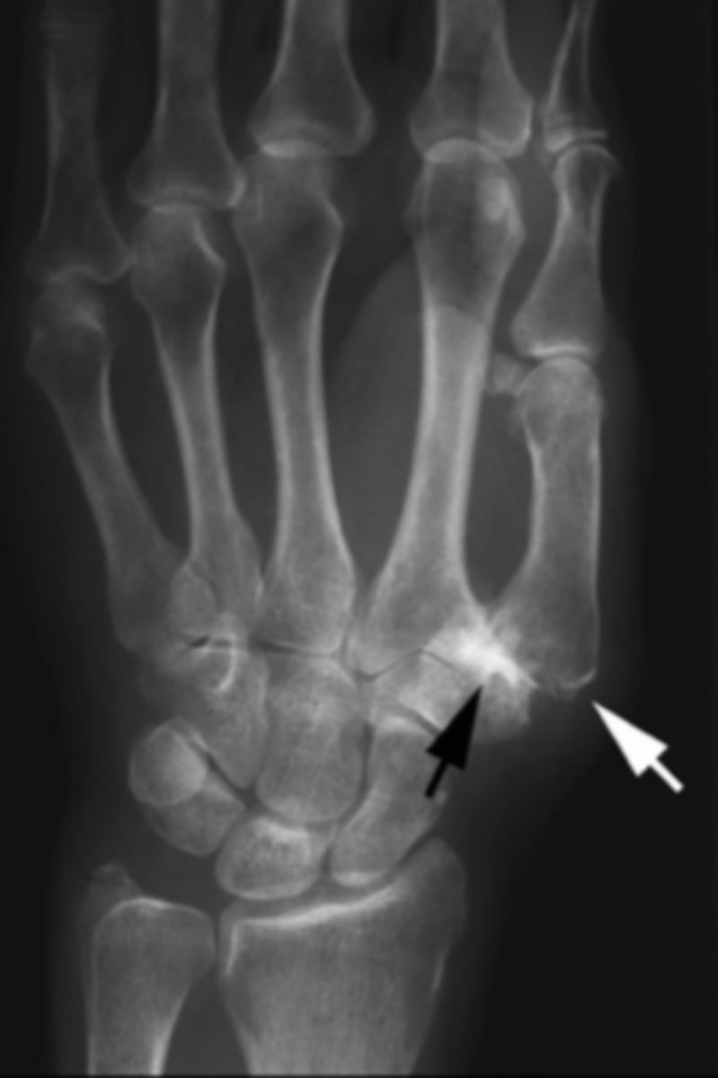 <p>What is the issue?</p>