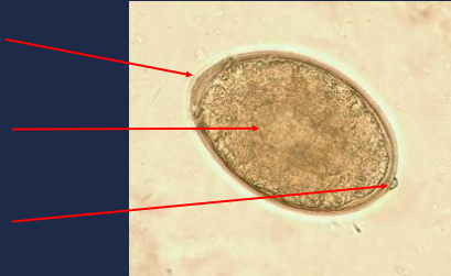 State the name of the part on the upper portion of the picture.