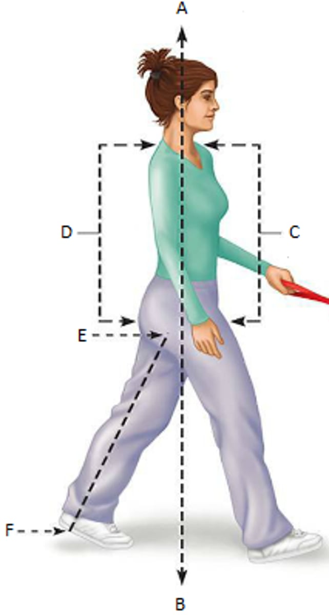 <p>What is the term for the directional word indicated by the letter E?</p>