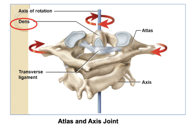 <p><strong>a pivot joint. </strong><br><strong> </strong><br>its where the <strong>C1 vertebra (atlas)</strong> and <strong>C2 vertebra (axis)</strong> meet. </p><p>This joint lets your head <strong>rotate side-to-side</strong> (like shaking your head "no").</p>