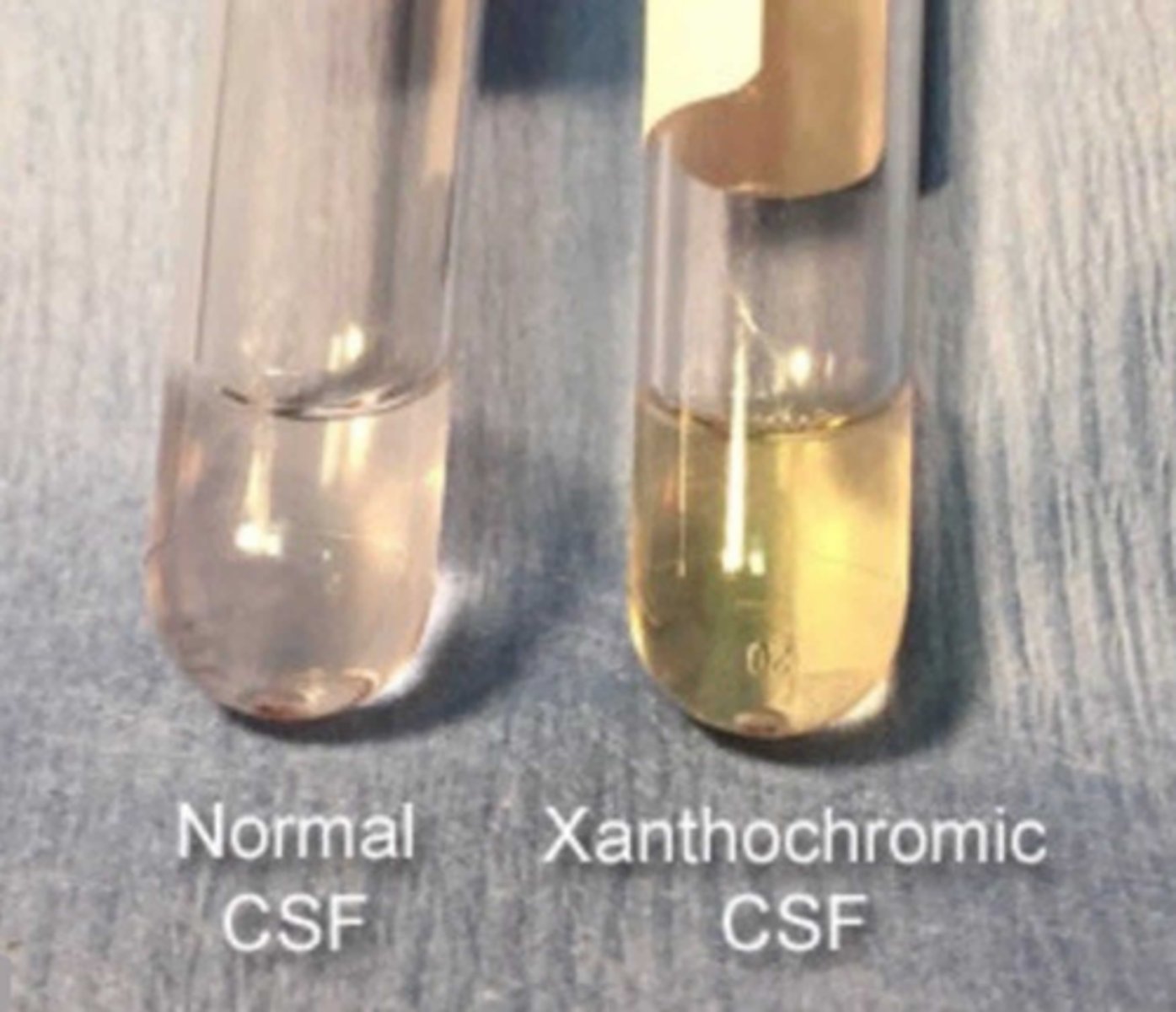 <p>Clear.</p><p>It does not have RBC</p>