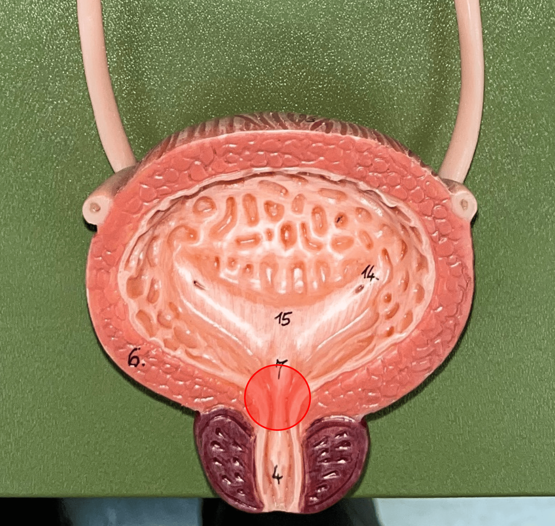 • Part of the urinary bladder.

• The anterior opening of the bladder leading to the urethra.