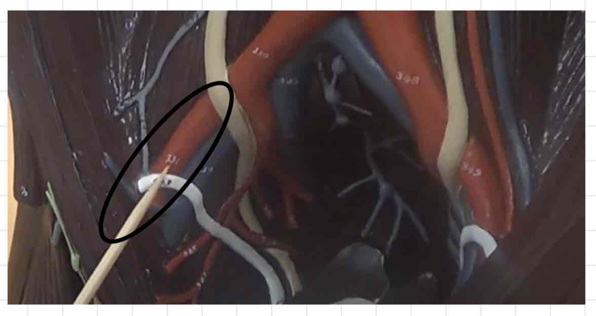 <p>what is this? (torso model)</p>