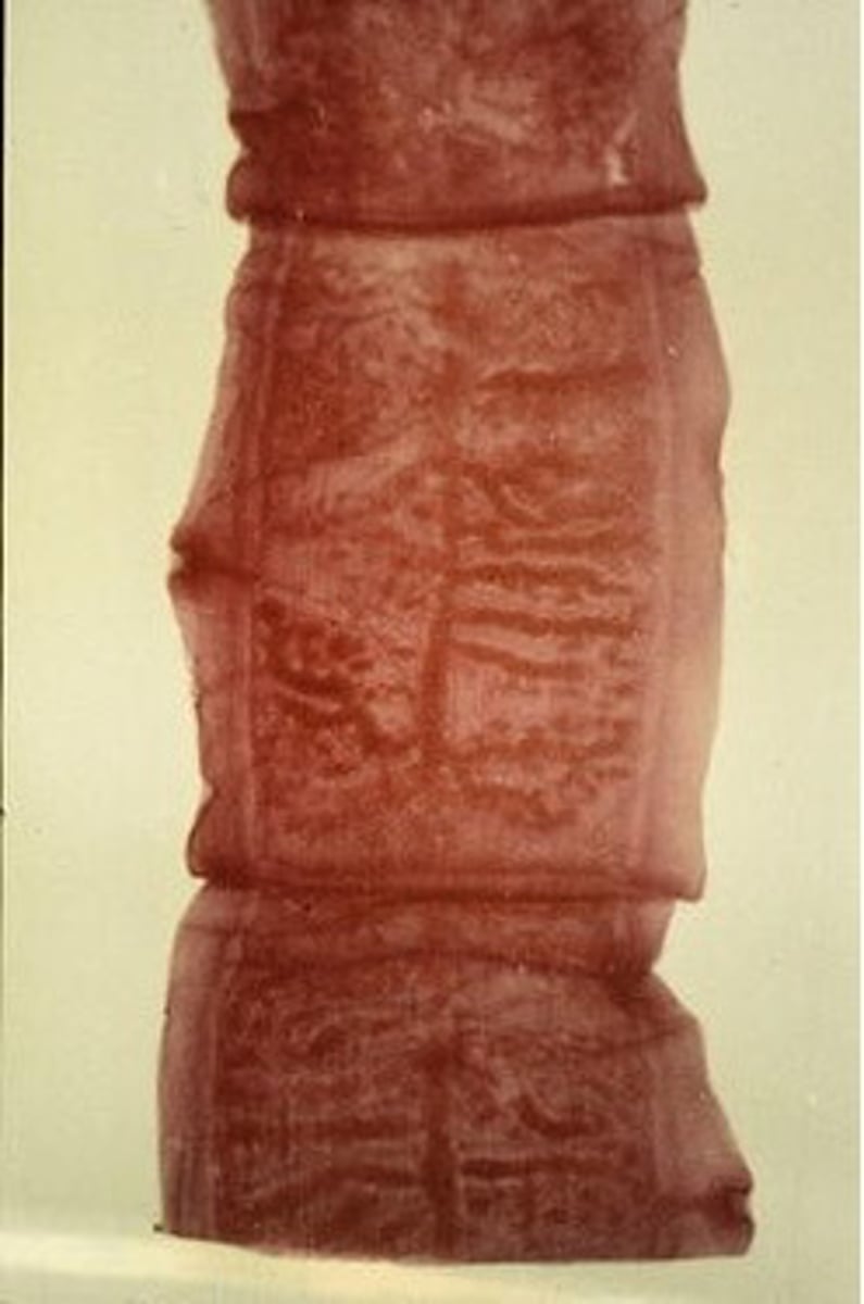 <p>Found in a wild cat. What parasite species is this?</p>