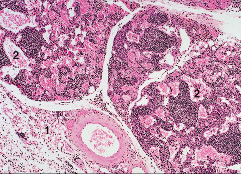 <p>Hemal lymph node, cow</p>