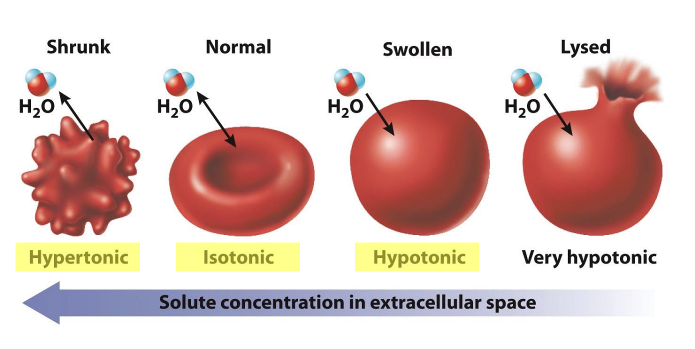 <ul><li><p class="Paragraph SCXO186949412 BCX0" style="text-align: left;"><span style="background-color: inherit; line-height: 19.55px; color: windowtext;"><span>Animals cells do not have cell wall--&gt; cells are fragile and only have control of osmosis</span></span><span style="line-height: 19.55px; color: windowtext;"><span>&nbsp;</span></span></p></li><li><p class="Paragraph SCXO186949412 BCX0" style="text-align: left;"><span style="background-color: inherit; line-height: 19.55px; color: windowtext;"><span>Some cells burst or become compressed</span></span><span style="line-height: 19.55px; color: windowtext;"><span>&nbsp;</span></span></p></li><li><p class="Paragraph SCXO186949412 BCX0" style="text-align: left;"><span style="background-color: inherit; line-height: 19.55px; color: windowtext;"><span>Human blood cells</span></span><span style="line-height: 19.55px; color: windowtext;"><span>&nbsp;</span></span></p><ul><li><p class="Paragraph SCXO186949412 BCX0" style="text-align: left;"><span style="background-color: inherit; line-height: 19.55px; color: windowtext;"><span>Red blood cell placed in hypertonic solution</span></span><span style="line-height: 19.55px; color: windowtext;"><span>&nbsp;</span></span></p><ul><li><p class="Paragraph SCXO186949412 BCX0" style="text-align: left;"><span style="background-color: inherit; line-height: 19.55px; color: windowtext;"><span>Higher concentration outside than inside of cell</span></span><span style="line-height: 19.55px; color: windowtext;"><span>&nbsp;</span></span></p></li><li><p class="Paragraph SCXO186949412 BCX0" style="text-align: left;"><span style="background-color: inherit; line-height: 19.55px; color: windowtext;"><span>Water leave cell with osmosis --&gt; cell shrinks in extreme env</span></span><span style="line-height: 19.55px; color: windowtext;"><span>&nbsp;</span></span></p></li></ul></li><li><p class="Paragraph SCXO186949412 BCX0" style="text-align: left;"><span style="background-color: inherit; line-height: 19.55px; color: windowtext;"><span>Maintain same inside and outside concentration --&gt; isotonic</span></span><span style="line-height: 19.55px; color: windowtext;"><span>&nbsp;</span></span></p><ul><li><p class="Paragraph SCXO186949412 BCX0" style="text-align: left;"><span style="background-color: inherit; line-height: 19.55px; color: windowtext;"><span>Ideal for cels</span></span><span style="line-height: 19.55px; color: windowtext;"><span>&nbsp;</span></span></p></li><li><p class="Paragraph SCXO186949412 BCX0" style="text-align: left;"><span style="background-color: inherit; line-height: 19.55px; color: windowtext;"><span>Typical red blood cell</span></span><span style="line-height: 19.55px; color: windowtext;"><span>&nbsp;</span></span></p></li></ul></li><li><p class="Paragraph SCXO186949412 BCX0" style="text-align: left;"><span style="background-color: inherit; line-height: 19.55px; color: windowtext;"><span>Placed in hypotonic sol: higher solute concentration inside than outside</span></span><span style="line-height: 19.55px; color: windowtext;"><span>&nbsp;</span></span></p><ul><li><p class="Paragraph SCXO186949412 BCX0" style="text-align: left;"><span style="background-color: inherit; line-height: 19.55px; color: windowtext;"><span>Water moves into cell --&gt; cell have no cell wall --&gt; keeps adding water --&gt; swells --&gt; bursts in extreme situations</span></span><span style="line-height: 19.55px; color: windowtext;"><span>&nbsp;</span></span></p></li></ul></li></ul></li></ul><p></p>