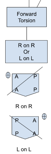 <ul><li><p>axis is opp. of lateralization (seated flexion test)</p></li><li><p>R on R → left sulci + ILA both ant.</p></li><li><p>L on L → right sulci + ILA both ant.</p></li></ul><p></p>