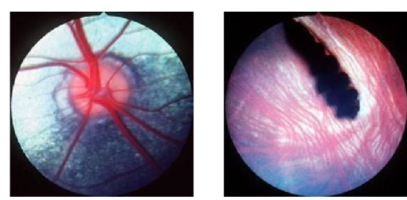<ul><li><p>retina is avascular</p></li><li><p>± papillary cone (in lizards and some snakes)</p></li></ul><p></p>