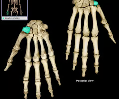 <p>Thumb range of motion </p>