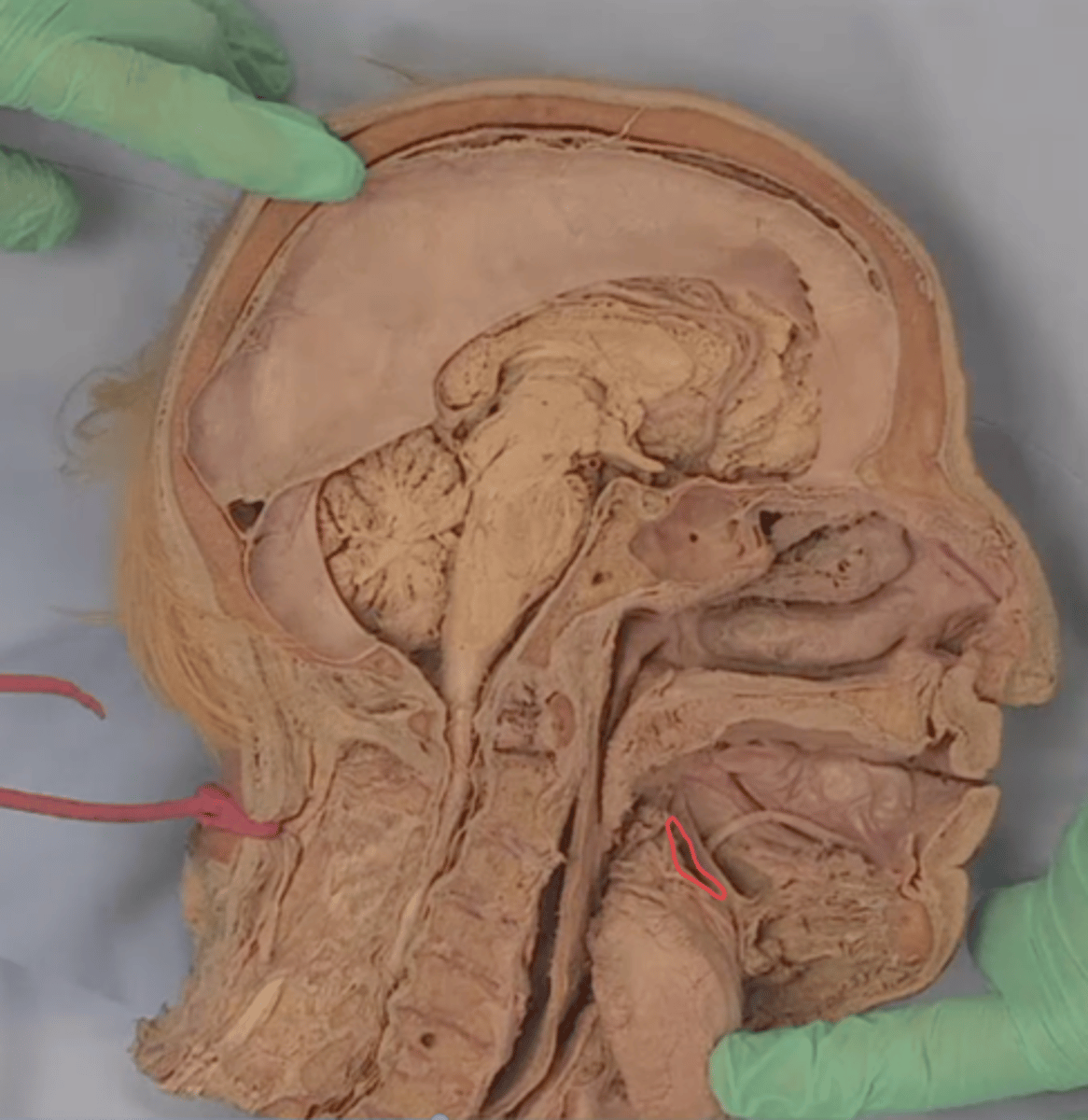 <p>identify structure that lies here (tongue reflected, deep to lingual nerve)</p>
