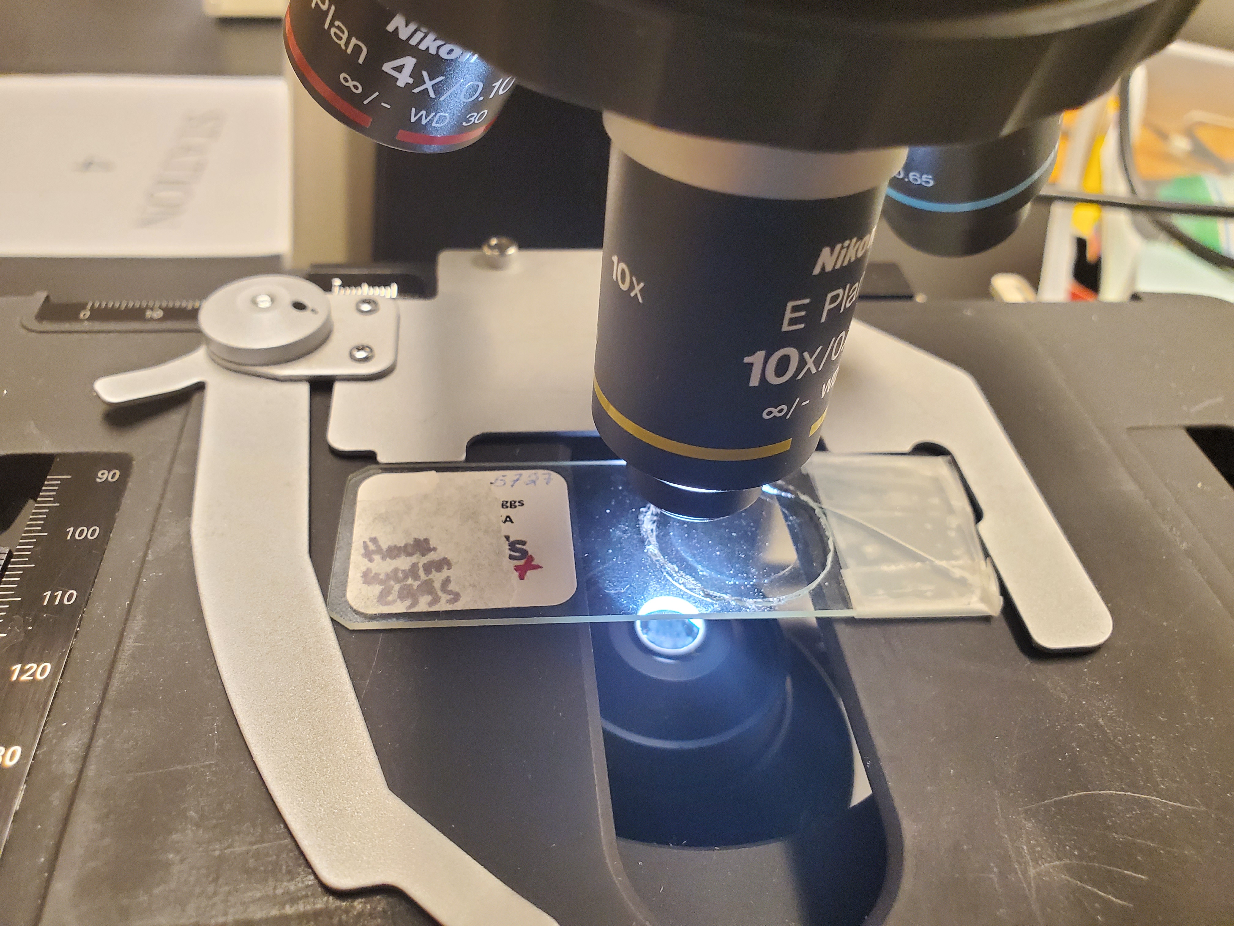 <p>Hookworm (Ancylostoma) Eggs</p>