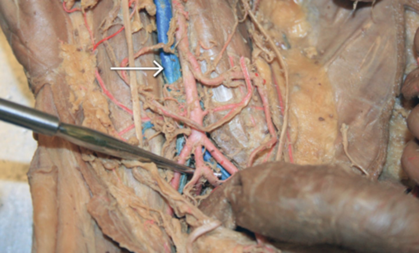 <p>(where white arrow's pointing to)</p>