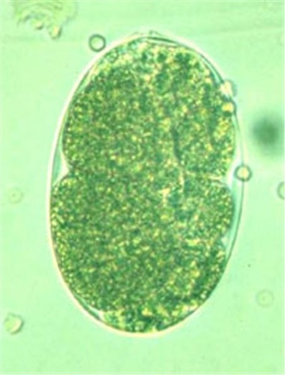 <p>This was found in the urine of a pig. What is it?</p>