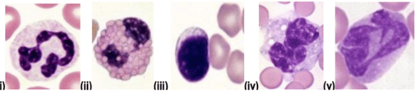 <p>Which of the cells illustrated in Plate 1 are most likely to be increased in the blood of an animal with intestinal parasitism?</p>