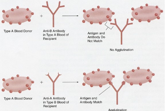 Blood transfusion reactions