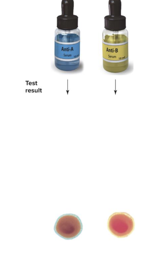 <p>Name the blood type</p>