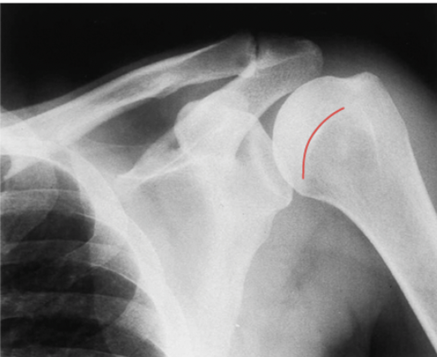 <p>What structure is highlighted?</p>
