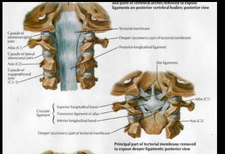 <p>1-Cruciform Ligament a-Transverse lig b-Longitudinal lig 2-Apical Ligament 3-Alar Ligament 4-Tectorial Membrane</p>