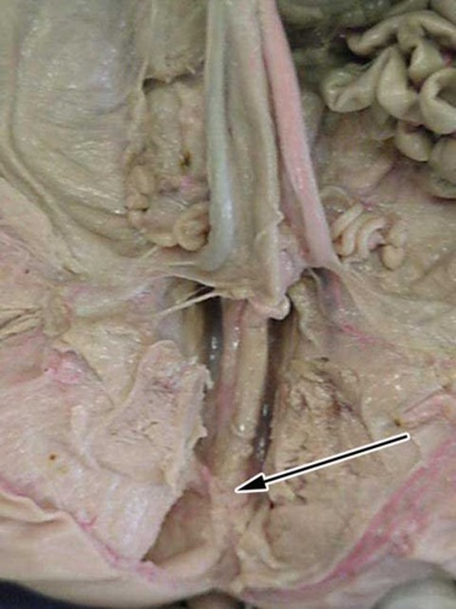 <p>Urogenital sinus</p>