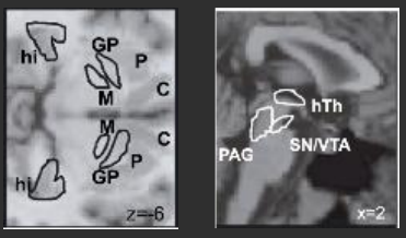 <p>VTA, stratium (caudate, putamen, globus pallidus). </p>