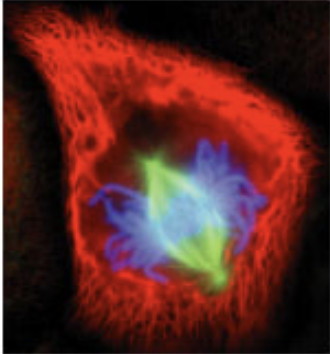 <p>what stage of mitosis?</p>