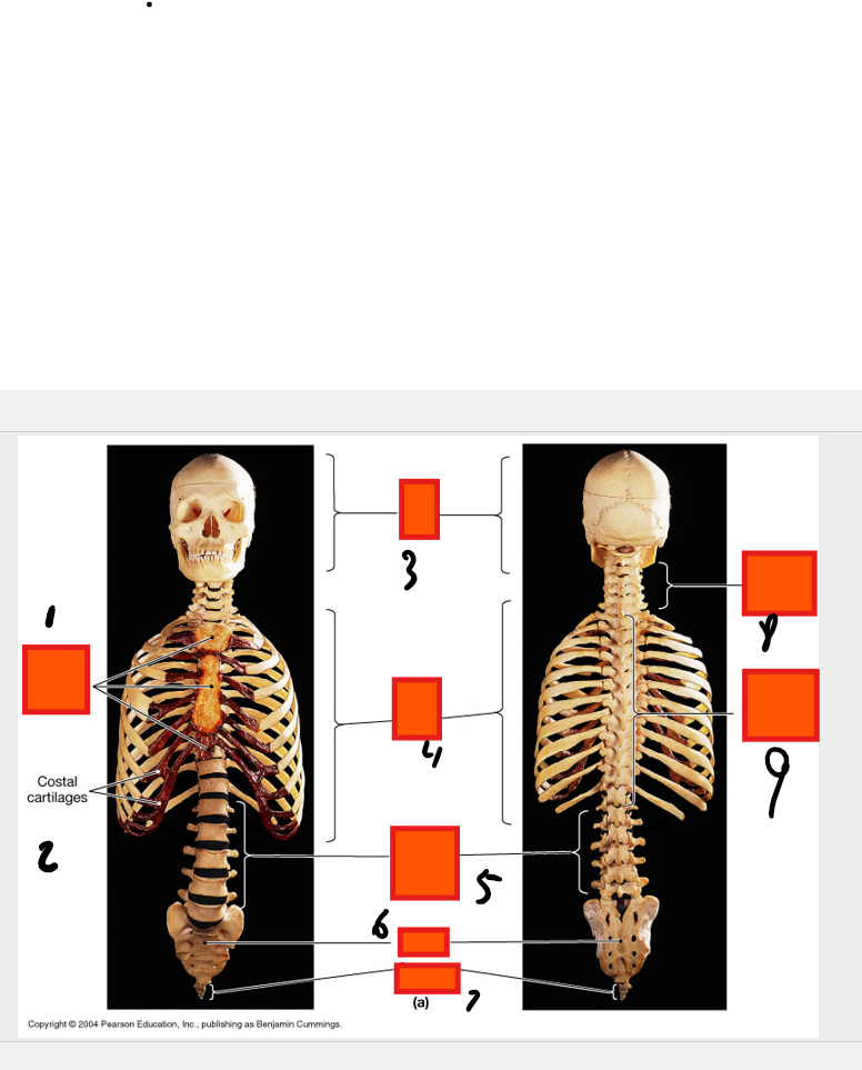 <p>costal cartilages</p>