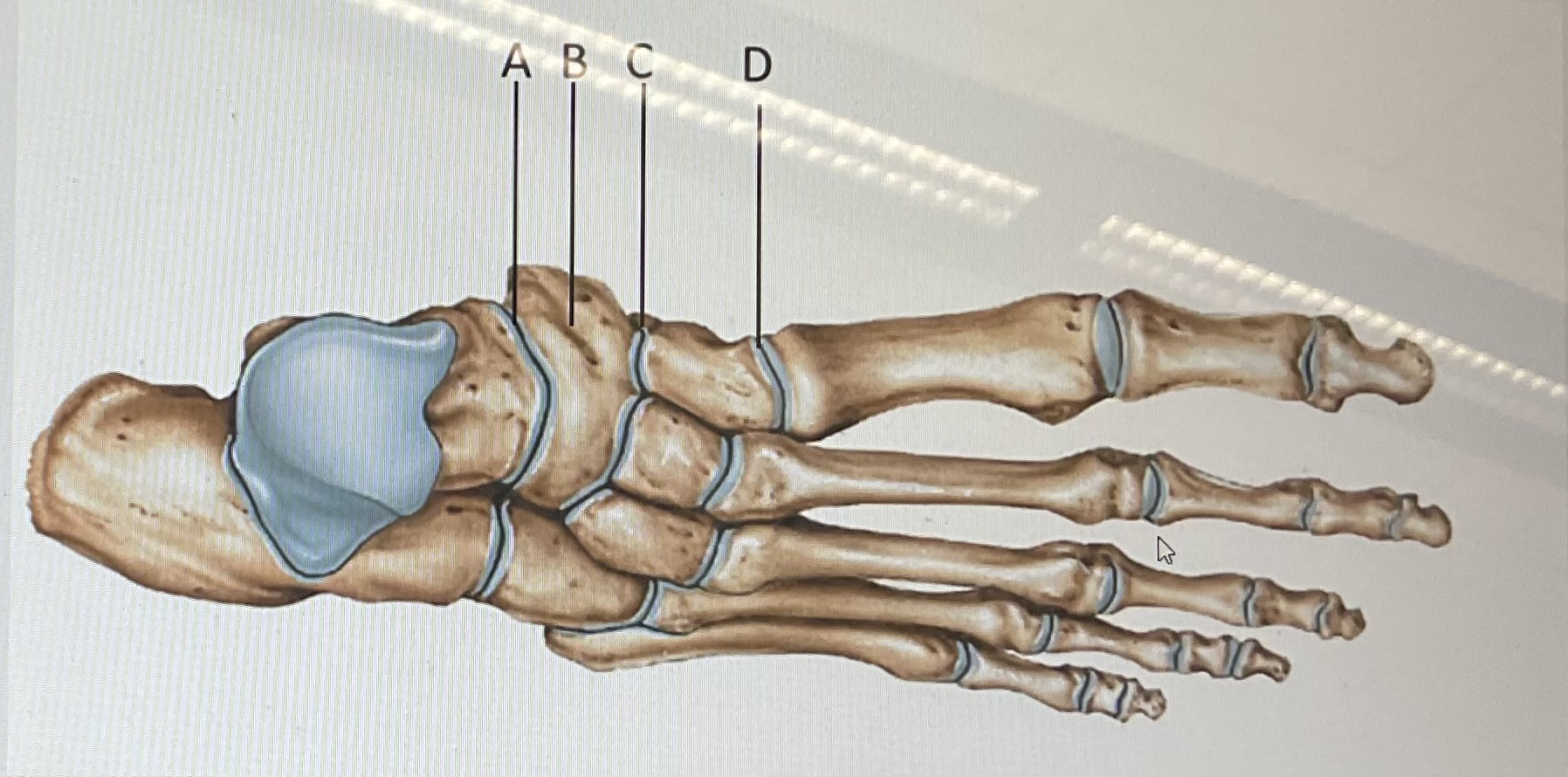 <p>identify the joint marked A</p>