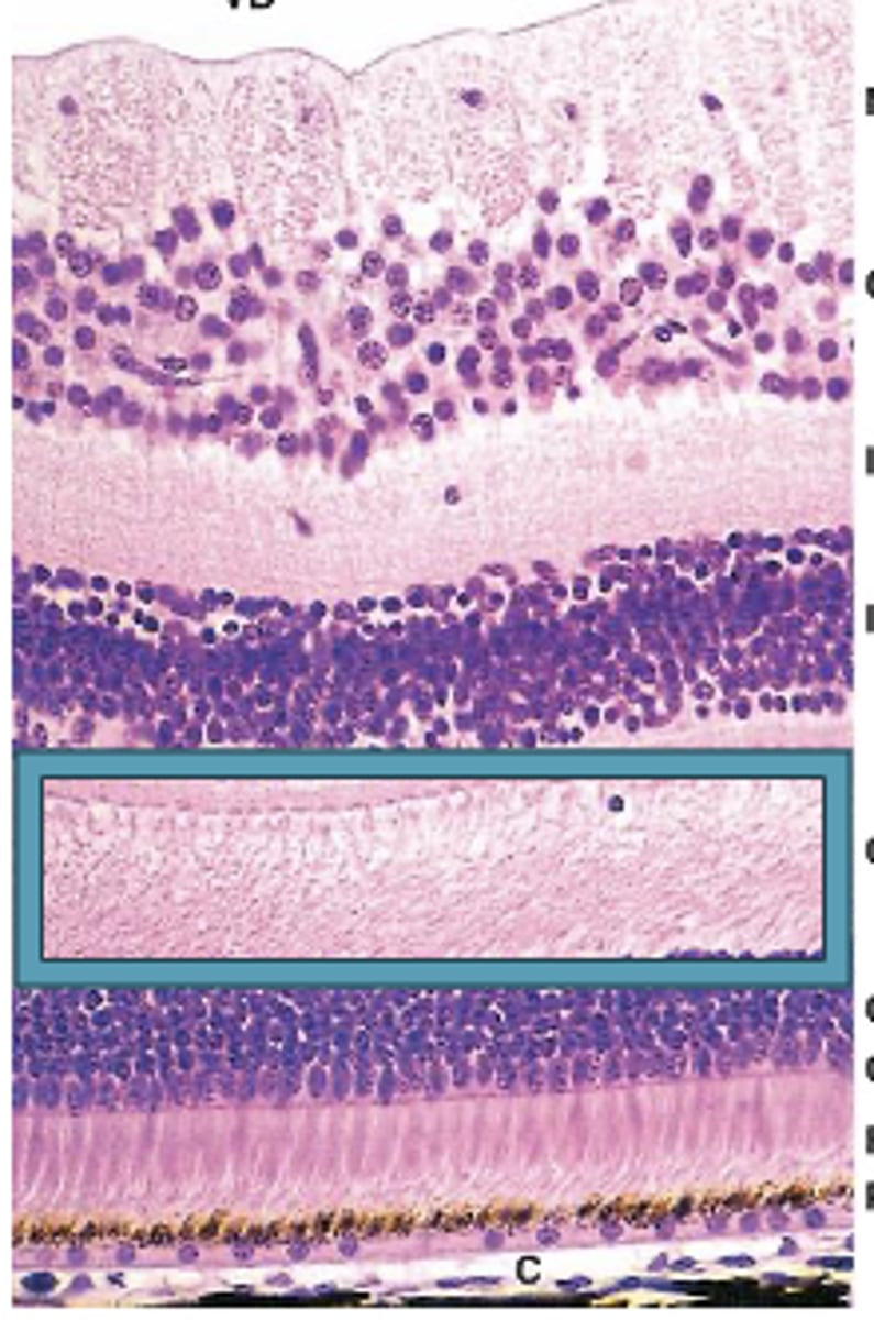 <p>Identify the Layers of the neural retina</p>