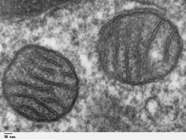 <p>Pros: Very high magnification, can view organelles and intercellular details</p><p>Cons: Preparation of samples requires fixation, expensive</p>