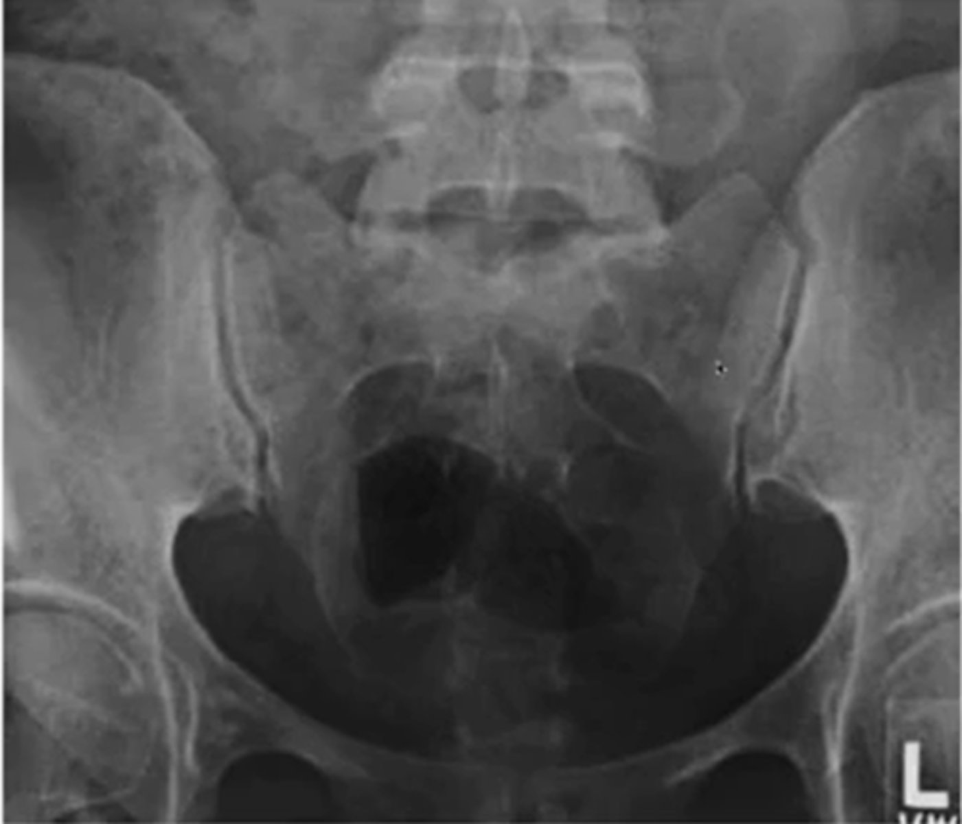 <p>AP (looking at the joint surface)</p><p>R/L oblique ( joint space)</p>