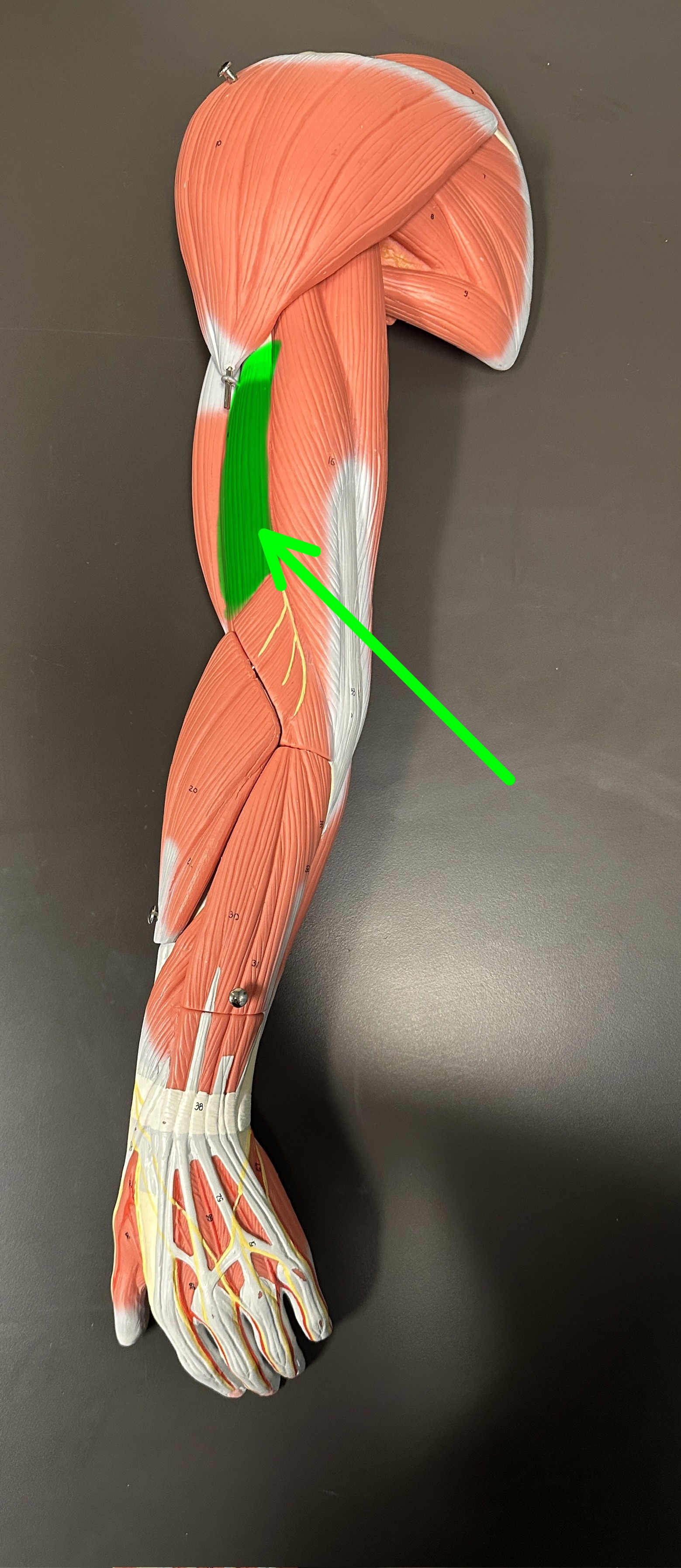 <p>What is the highlighted structure</p>