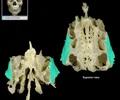 <p>This portion of the Ethmoid bone is its lateral border and forms part of the orbit.</p>
