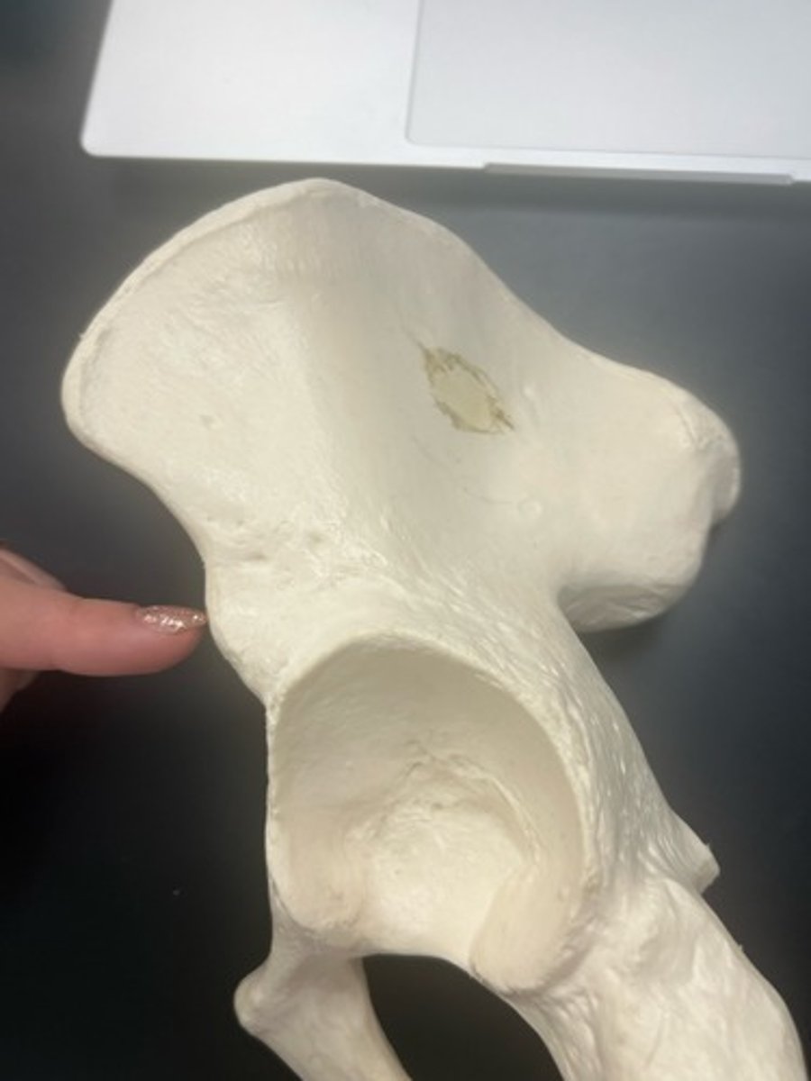 <p>name the bone</p>