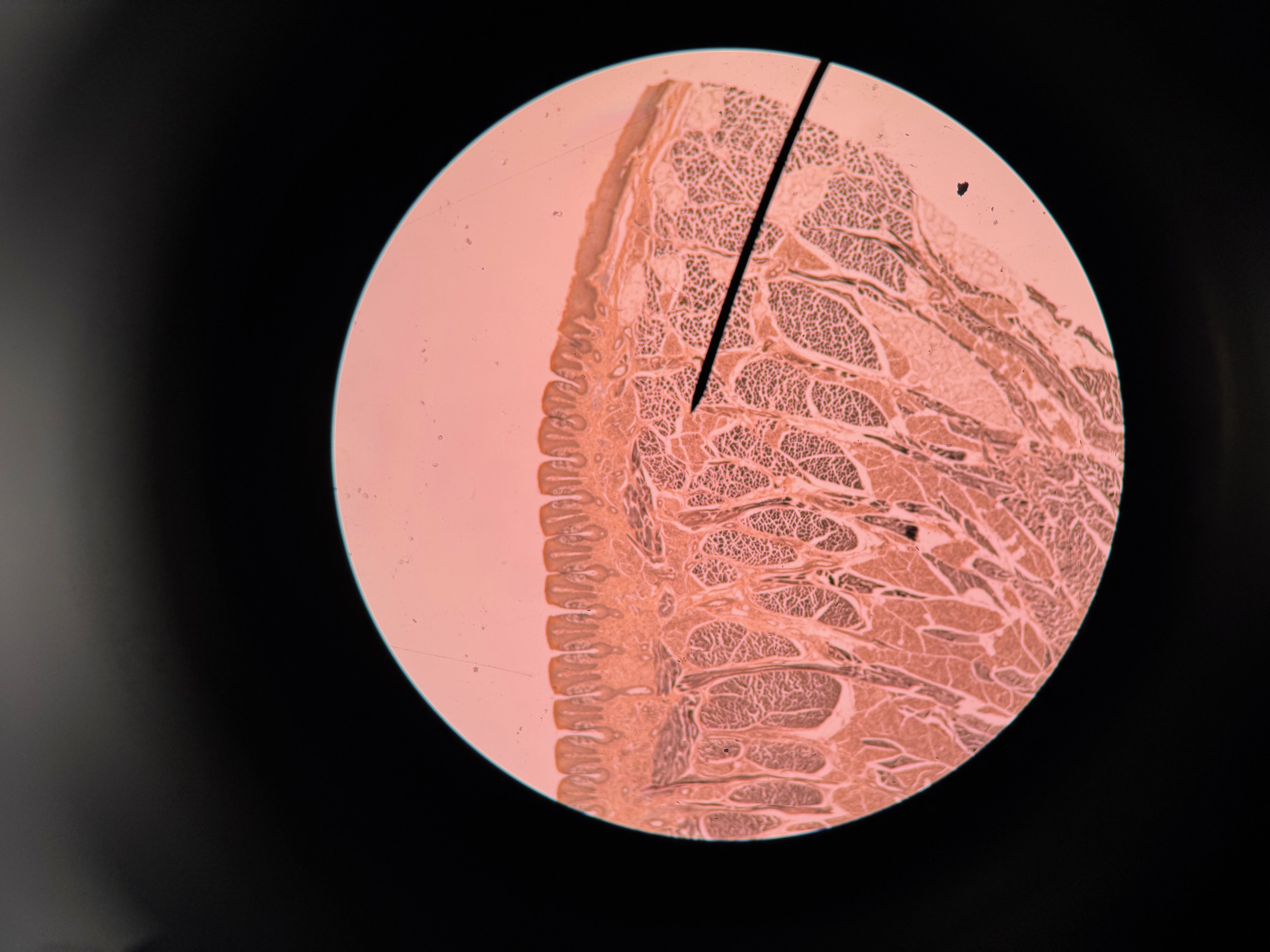 <p>Organ?</p>