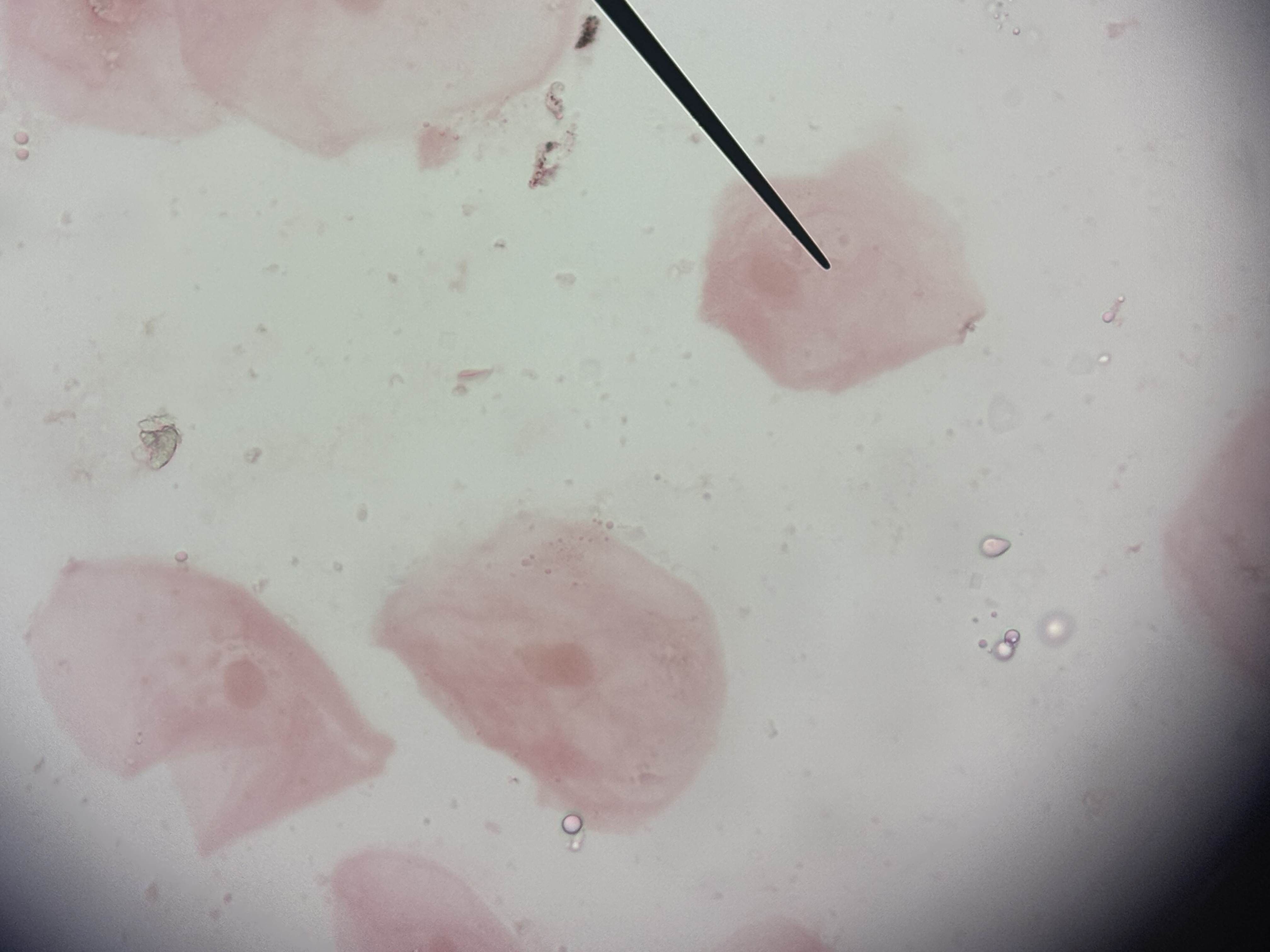 <p>single layer if cube like cells with disk shaped nuclei </p>