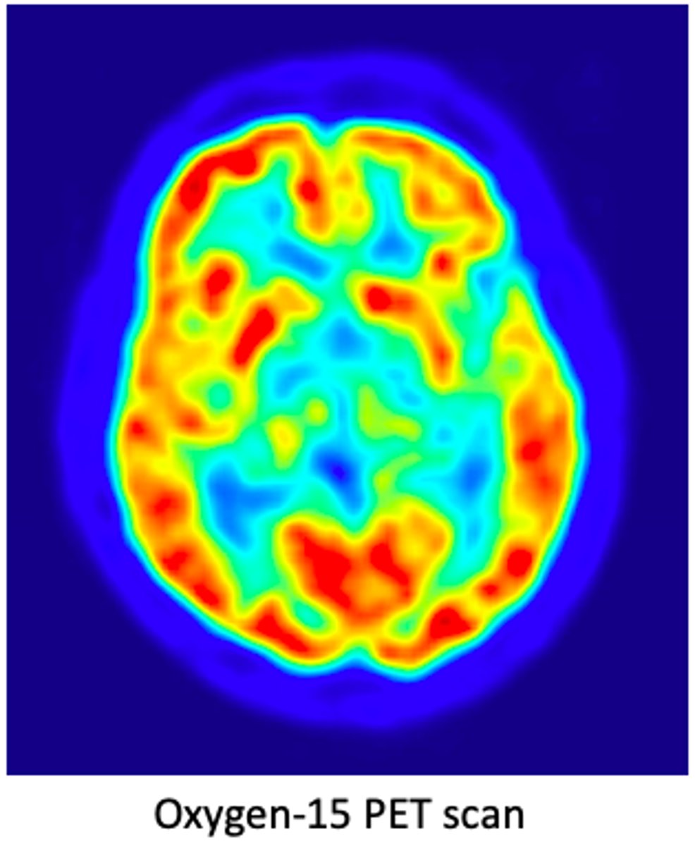 <p>- Mesure les variations de l'oxygénation sanguine dans le cerveau (technique BOLD)</p><p>- Réactions différentes de l'oxyhémoglobine et de la désoxyhémoglobine face au champ magnétique</p>