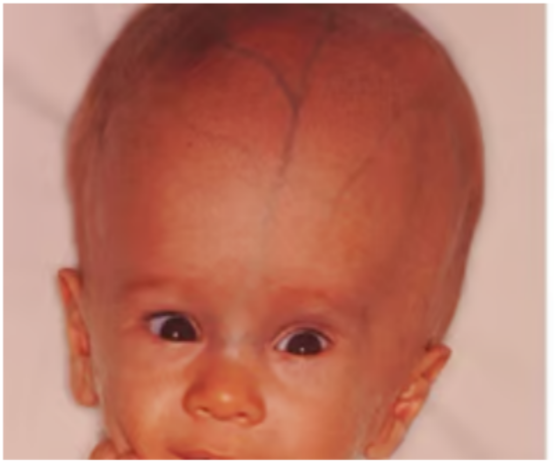 <p>What condition is this?</p>