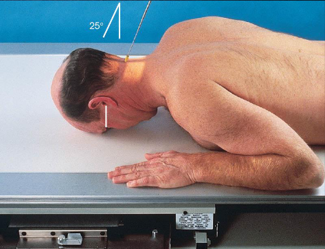 <ul><li><p>patient position:</p><ul><li><p>prone or upright</p></li><li><p>MSP centered to midline</p></li><li><p>shoulders in same horizontal plane</p></li></ul></li><li><p>part position:</p><ul><li><p>forehead and nose resting on Bucky/table</p></li><li><p>MSP perpendicular to IR</p></li><li><p>OML perpendicular to IR</p></li></ul></li><li><p>respiration suspended</p></li><li><p>CR:</p><ul><li><p>25 degrees cephalad to OML</p></li><li><p>enters 1 ½ inches below external occipital protuberance</p></li><li><p>exits 1 ½ inches superior to nasion</p></li></ul></li><li><p>collimation:</p><ul><li><p>1 inch beyond the skin line of the skull</p></li></ul></li></ul><p></p>